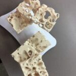 Osteoporosis bone